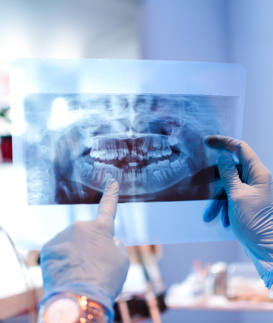 Wayne Valley Family Dentistry | Preventative Program, Dental Sealants and Dental Cleanings