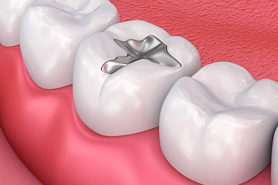 Wayne Valley Family Dentistry | Emergency Treatment, Dental Bridges and Dentures