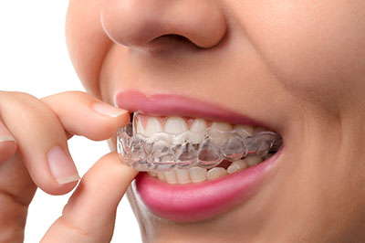 Wayne Valley Family Dentistry | Sports Mouthguards, Preventative Program and Dentures