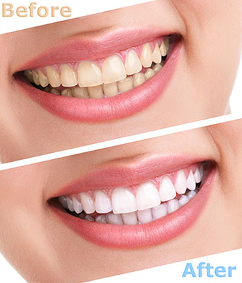 Wayne Valley Family Dentistry | Cosmetic Dentistry, Dental Bridges and Dentures