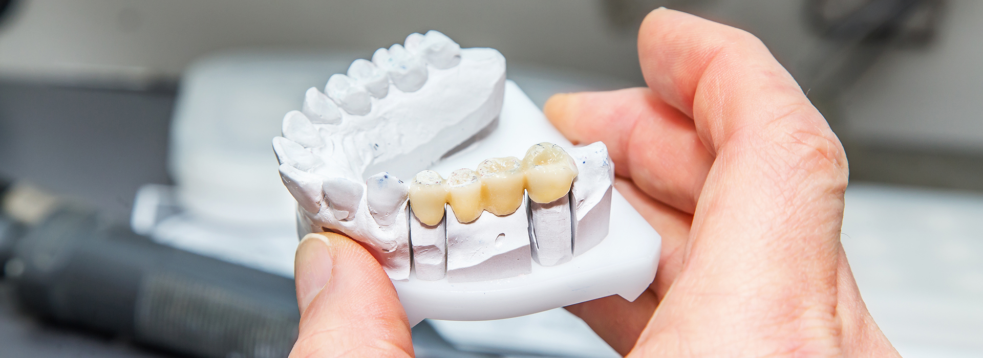Wayne Valley Family Dentistry | Dental Sealants, Inlays amp Onlays and Extractions