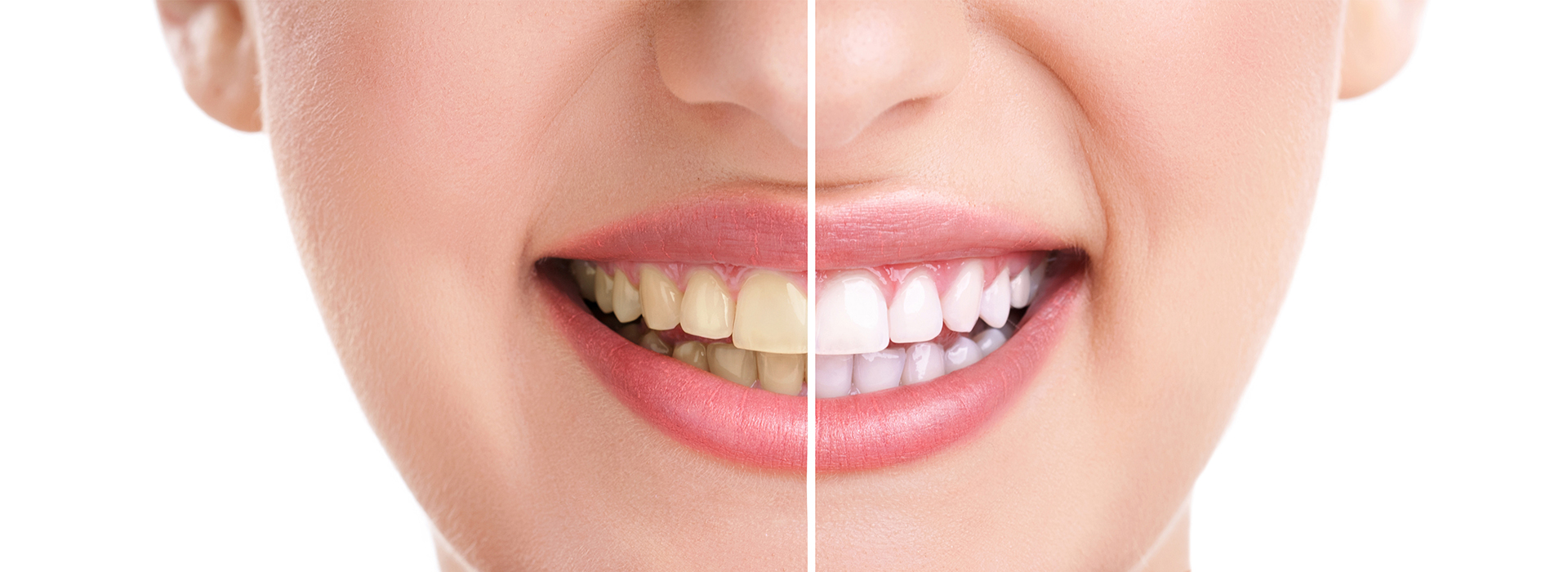 Wayne Valley Family Dentistry | Dental Sealants, Root Canals and Pediatric Dentistry