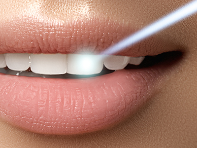 Wayne Valley Family Dentistry | Ceramic Crowns, E4D and Extractions